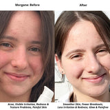 Book Your Free Virtual Skincare Consultation