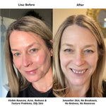 calm | anti-redness cleanser