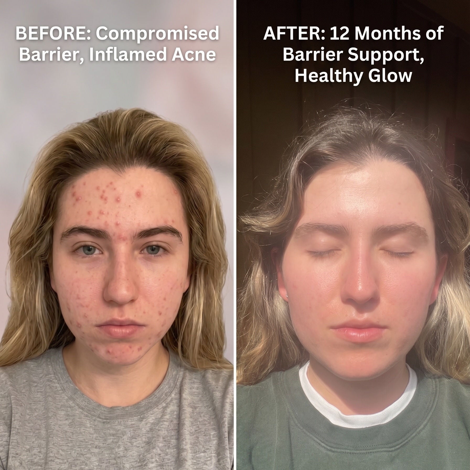The Myth: You Need to Exfoliate Daily